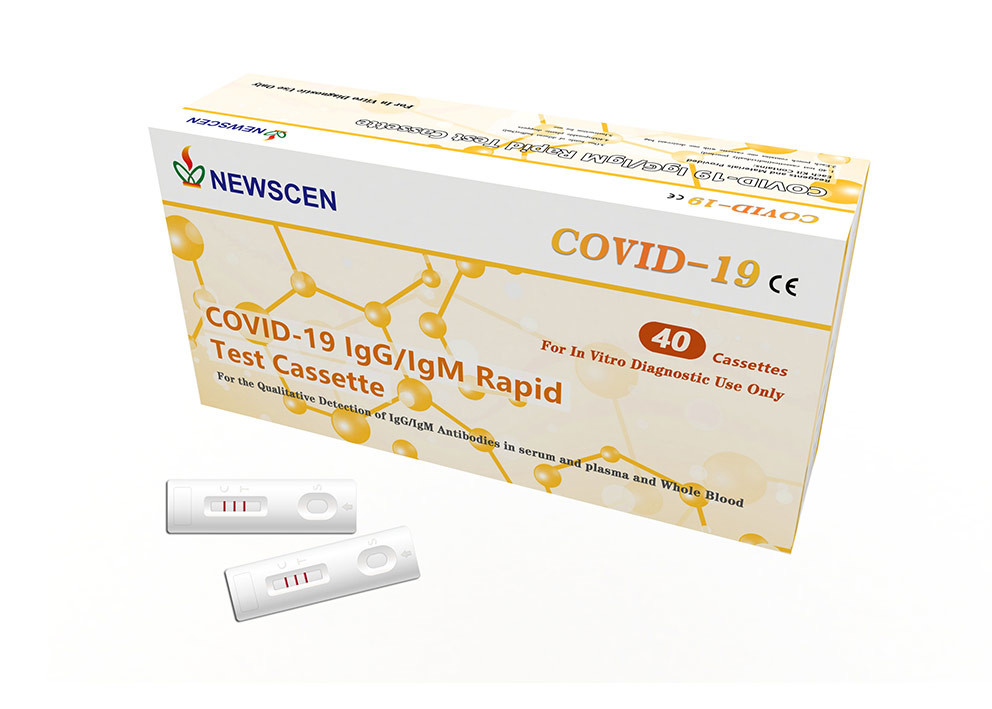 Kolloidale Serum-Plasma Coronavirus-Test-Ausrüstung der Goldsiebungs-10uL